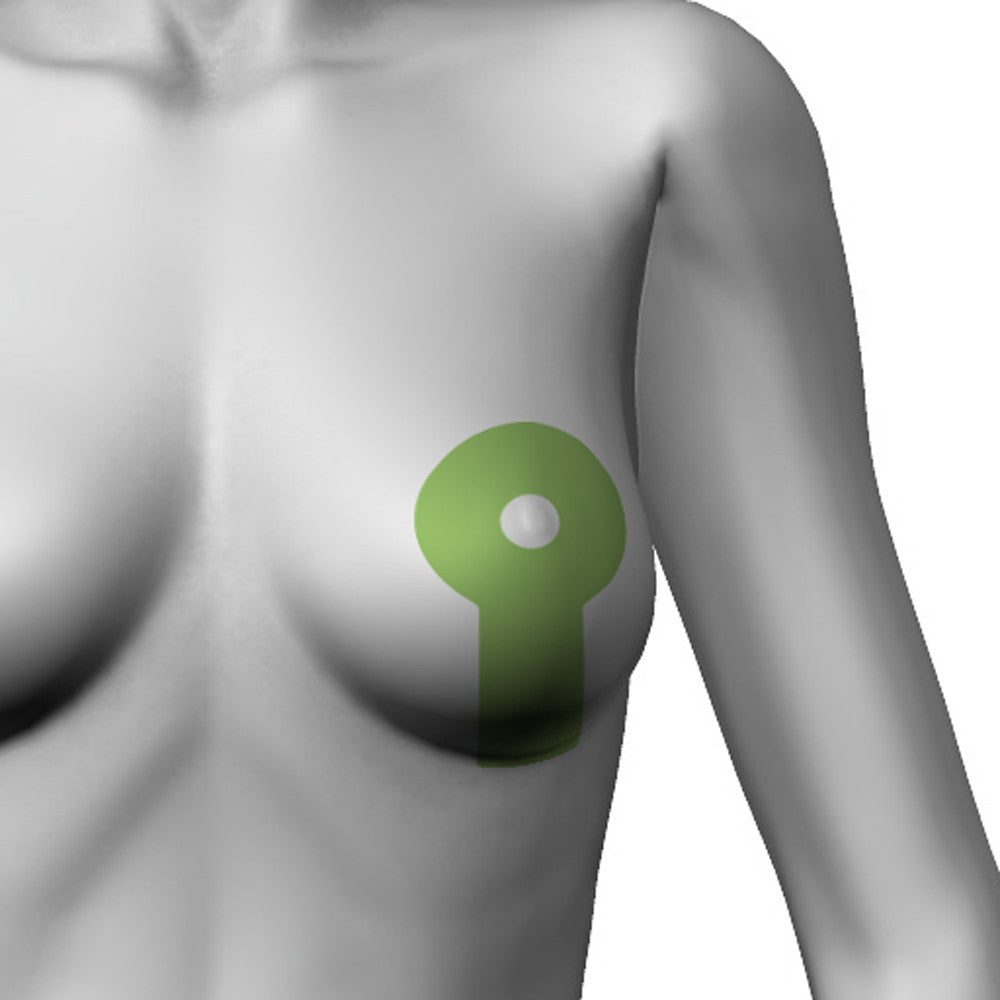 Adhesive silicone gel sheet for scar treatment, Lollypop shape