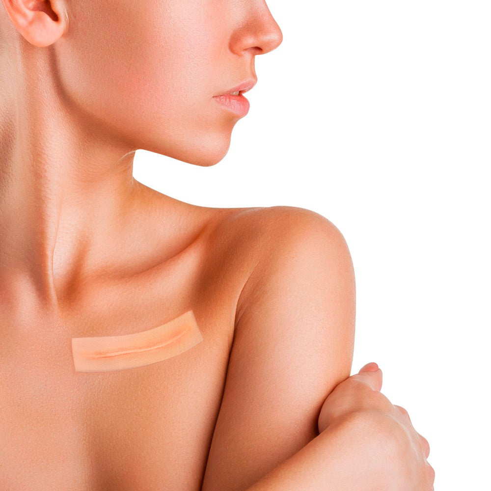 Adhesive silicone gel sheet for scar treatment, 5x20cm